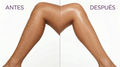 Depiladora YES Finishing Touch® — Indolora, Recargable y Para Todo el Cuerpo